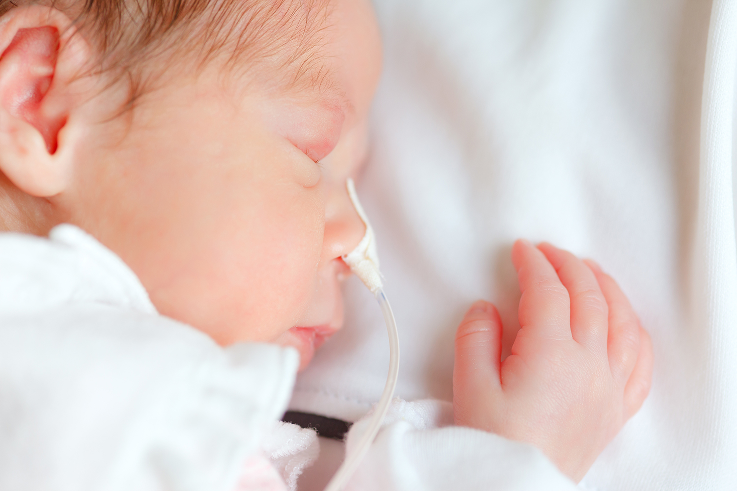 Ein friedlich schlafendes Baby, das die professionelle und einfühlsame Betreuung von Profi Gesundheits-Service im Bereich der pädiatrischen enteralen Ernährung darstellt.
